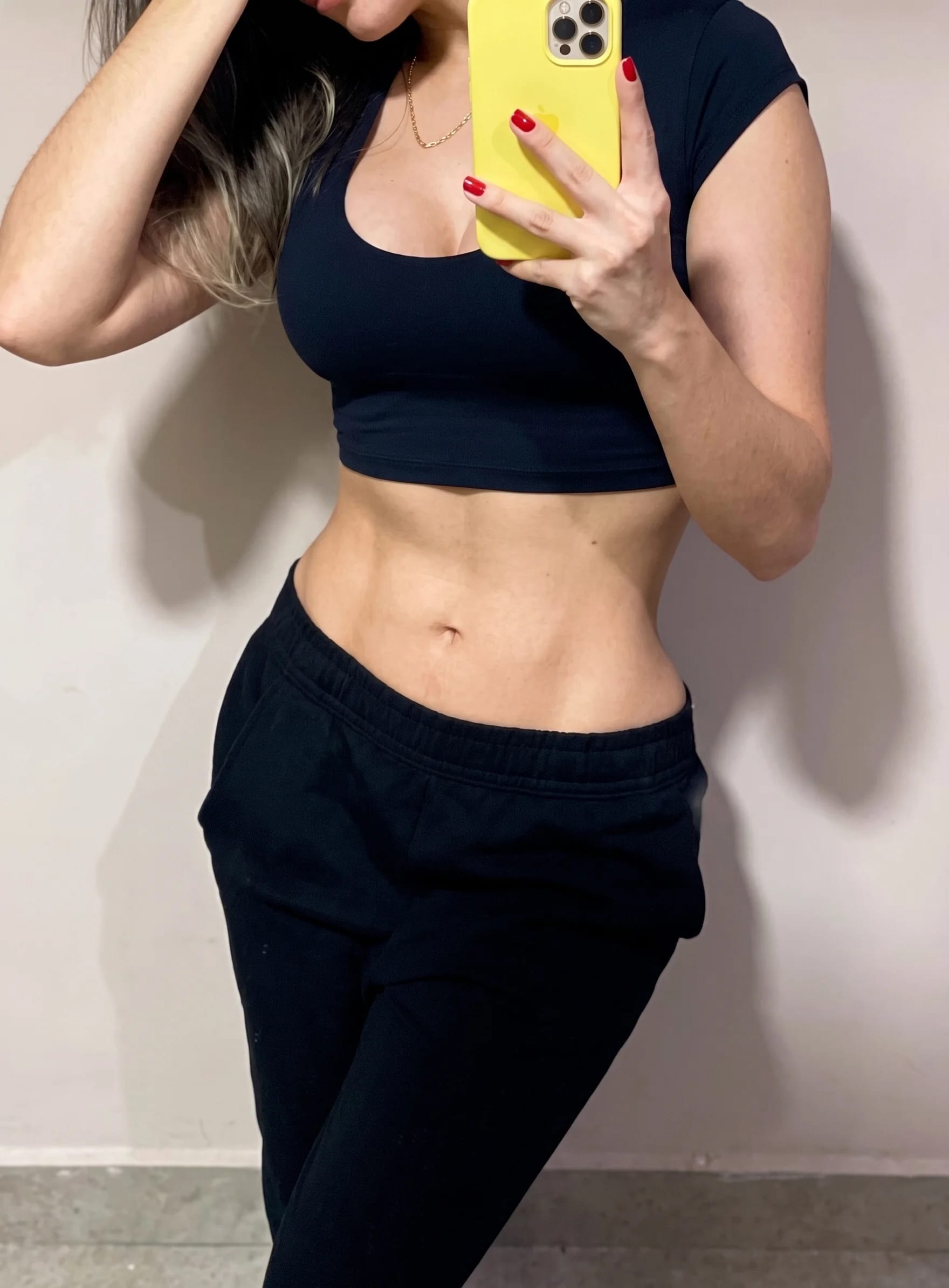 Resultado de cirurgia plástica com o Dr. Vinicius Spiandorello em Joinville: paciente de top e calça, foco no abdômen.